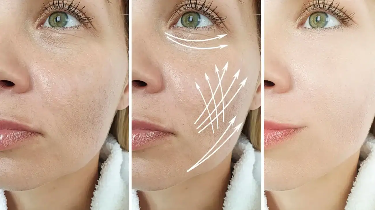 Can One Treatment Really Tackle More Than One Skin Concern Chesterfield?