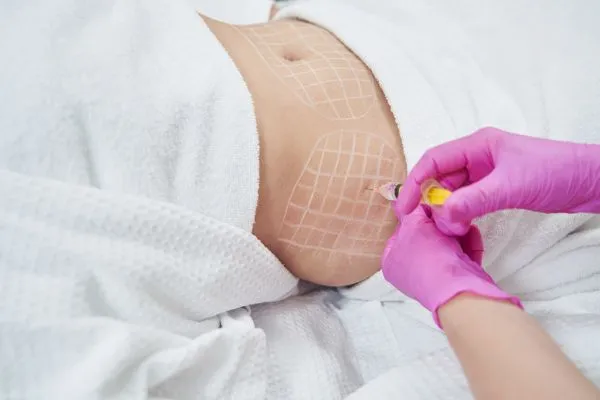 image of fat dissolving injections on love handles to help combat weight gain Chesterfield