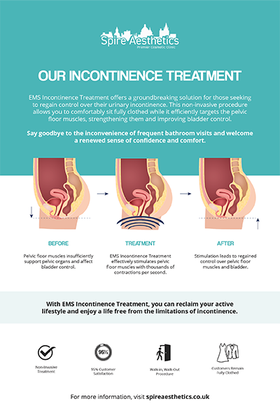 image to show how EMS treatment works for female urinary incontinence Chesterfield
