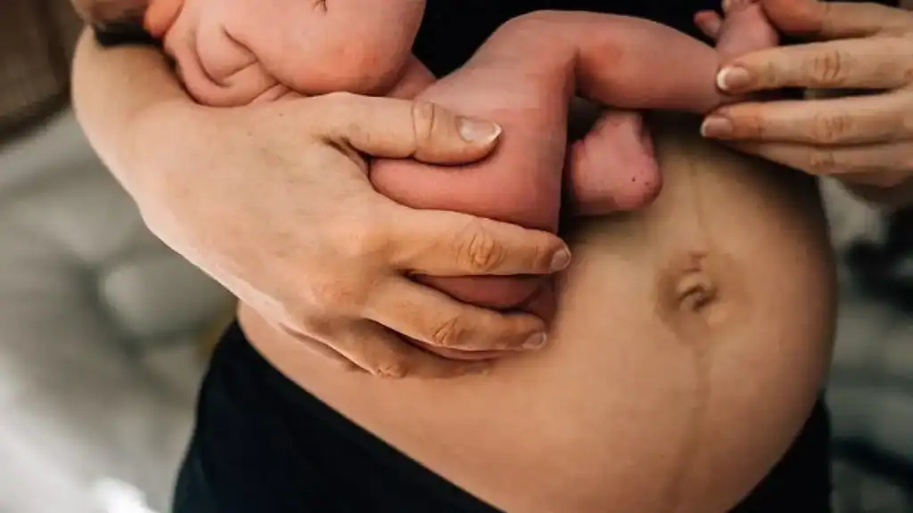 Why Is My Stomach Still Big After Pregnancy Chesterfield?